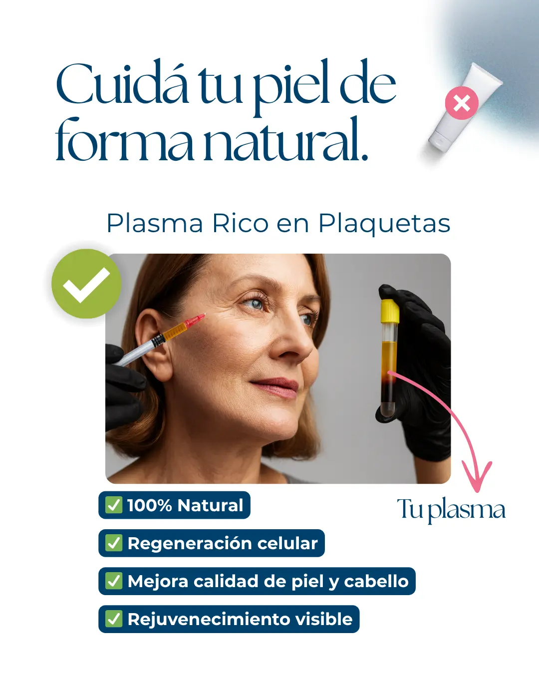 Aplicación de Plasma Rico en Plaquetas (PRP) en rostro de paciente madura en clínica estética en Caballito. Tratamiento natural de rejuvenecimiento.